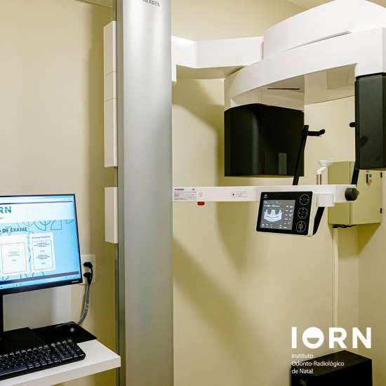 Tomografia computadorizada Cone Beam