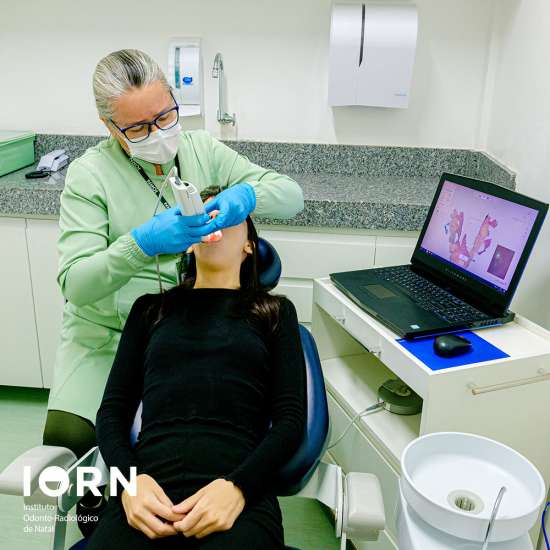 Escaneamento intra-oral
